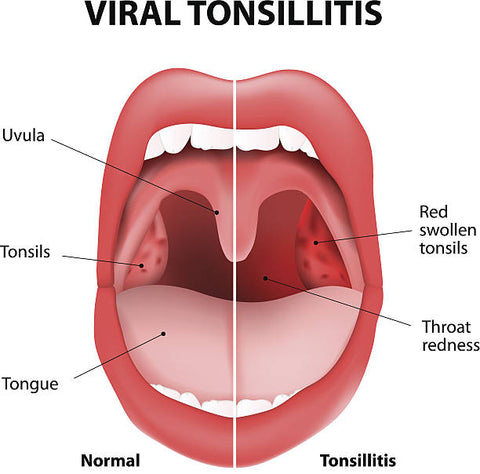 The Tonsils: Understanding this Important Part of Your Immune System