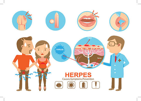 "Living with Herpes: Navigating Relationships and Stigma"