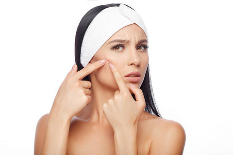 Acne and Pimple Treatment with Chandan