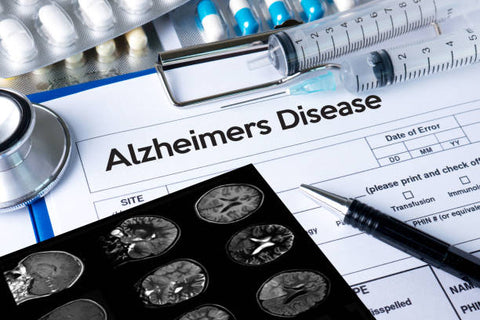 Alzheimer's Disease: Understanding the Symptoms, Causes, and Treatment