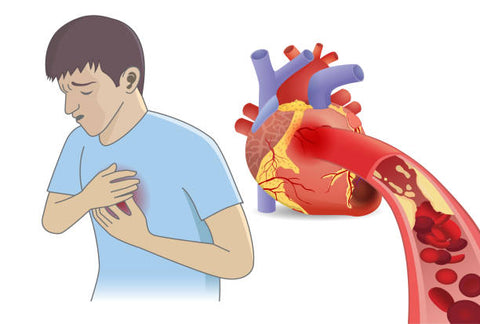 Chest Pain: Causes, Symptoms, and Treatment