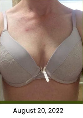 BreastyCare Herbal Breast Enhancement Lymphvity Detoxification Plasters Patch