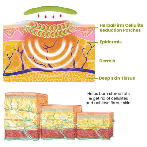 Audgx HerbalFirm Cellulite Reduction Patches