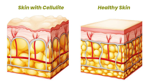 Oveallgo™ HerbalFirm Cellulite Reduction Patches