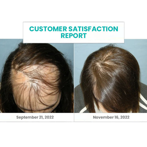 Peaufit™ ScalpReboost Ultra NMN Hair Growth Roller