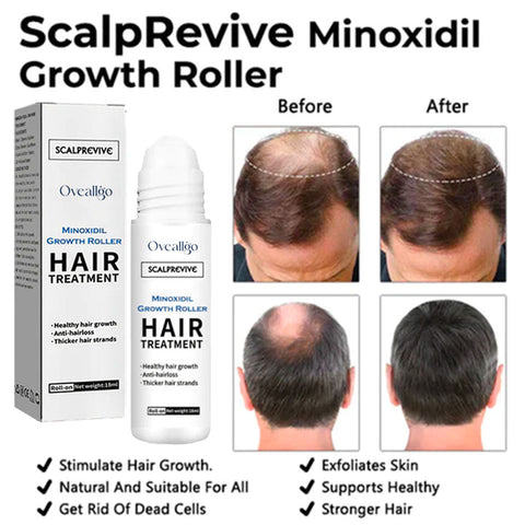 Oveallgo™ ScalpRevive Minoxidil Growth Roller