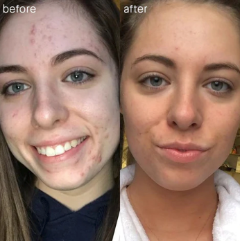 Oeallgo™ AgelessComplexion Sugar Defense Patch
