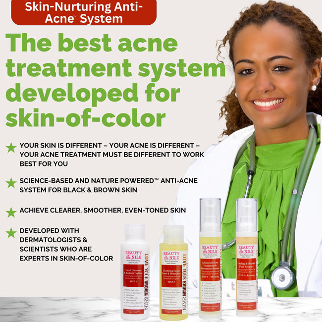 Best Acne Treatment for Dark Skin