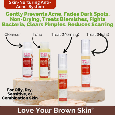Gently Prevents Acne - the Best Acne Treatment for Skin-of-Color Works