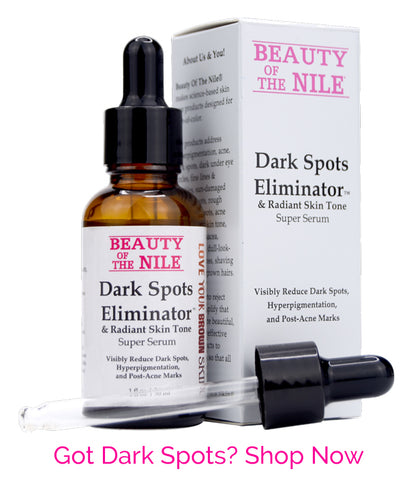 Dark Spots Bye-Bye Treatment is Here