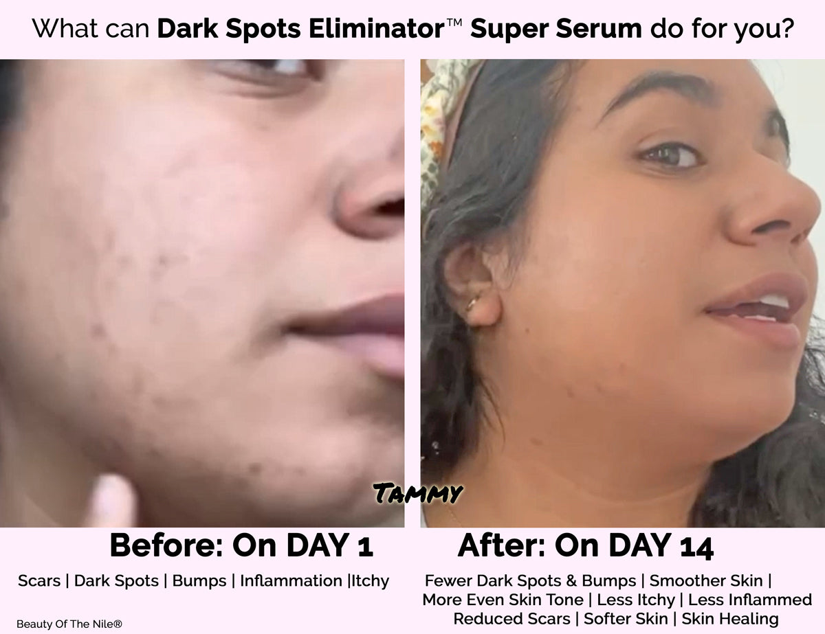 Dark Spots Eliminator Super Serum side-by-side