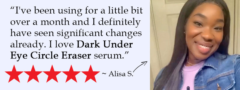 Dark Under Eye Circles testimonial -Alisa - Beauty Of The Nile