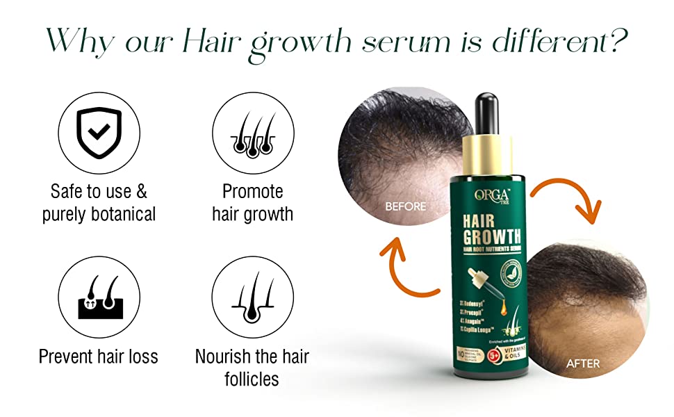 Hair Growth Serum That Actually Works