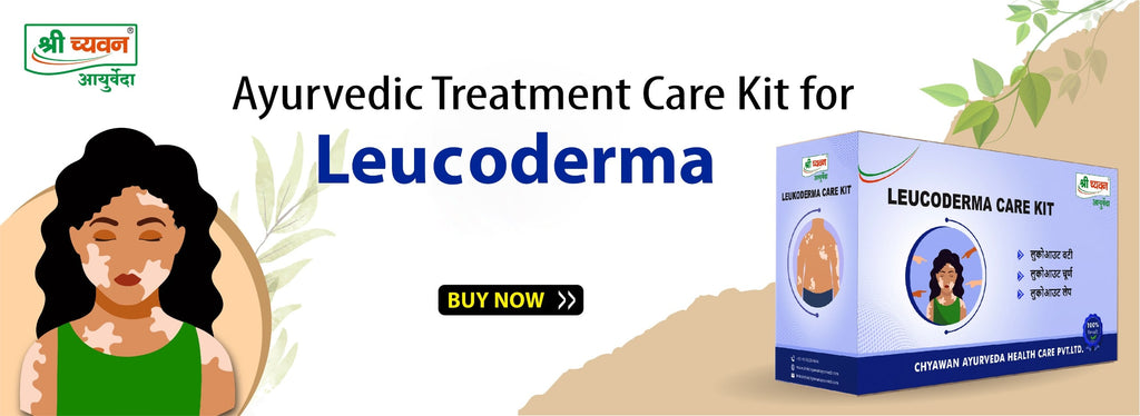 leucoderma treatment in ayurveda