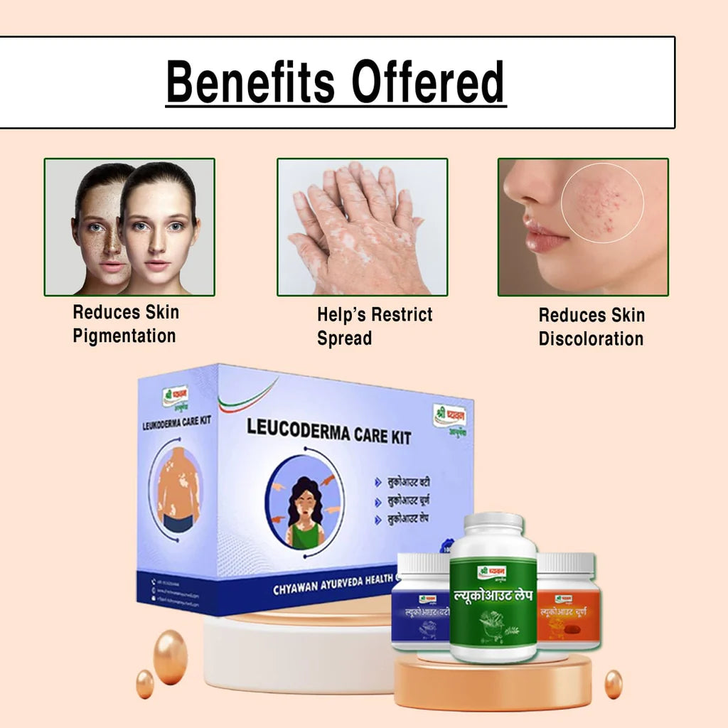 Ayurvedic Medicine for Safed daag Treatment