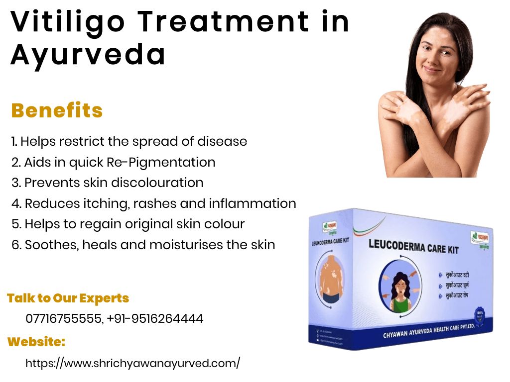 Vitiligo Treatment in Ayurveda