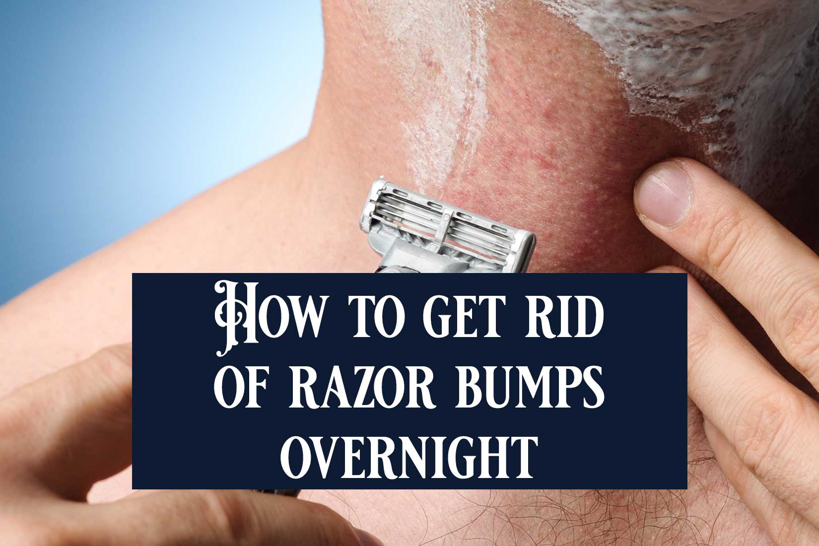 How To Get Rid Of Razor Bumps Overnight The Artisans Republic 