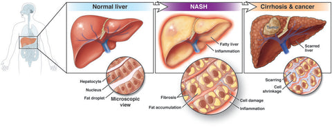 HepaSolution® - Advanced Liver Support Supplement for Optimal Liver Health