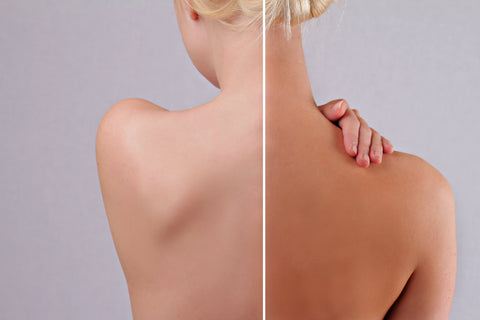 Woman's back with half tanned