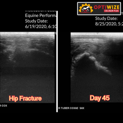 Dexter Tube Coxae Fracture