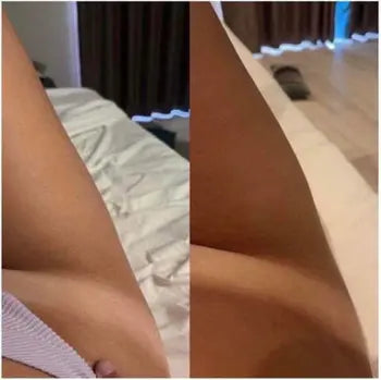 Before and After