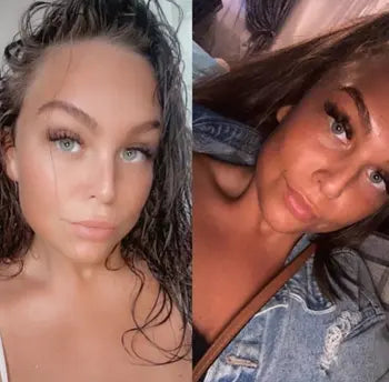 Before and After