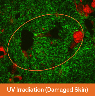 UV Irradiation (Damaged Skin)