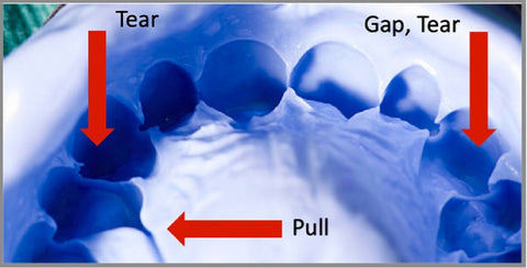Gap, Tear and Pull in a dental impression