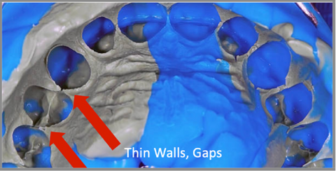 Thin wall and gap in dental impression