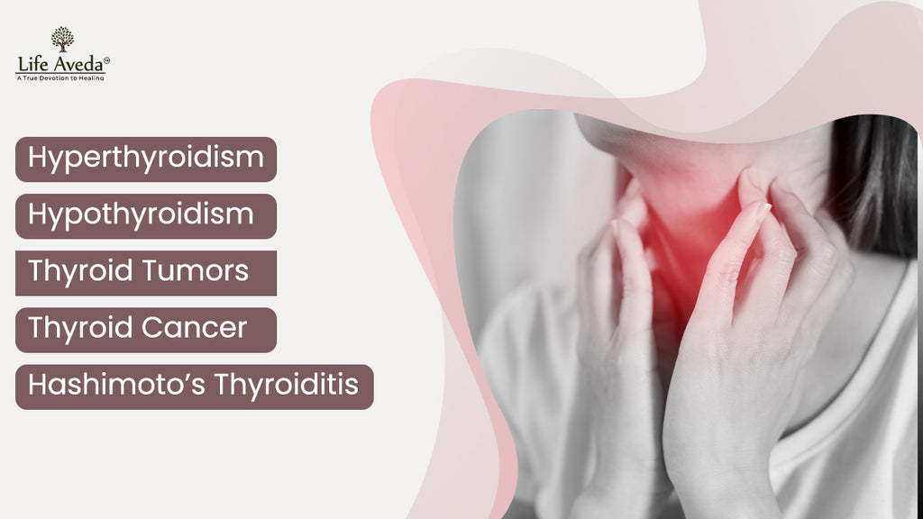 Conditions related to thyroid dysfunction