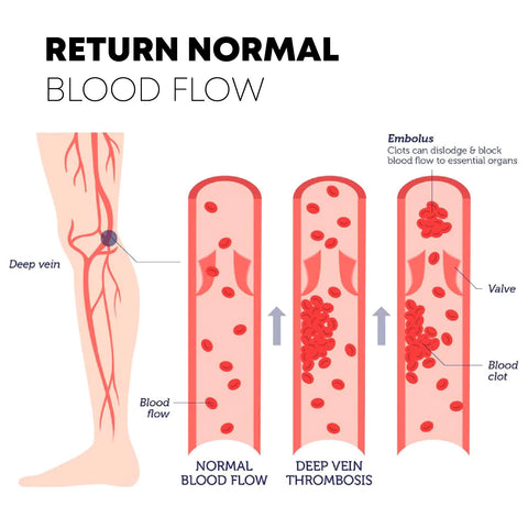 Tourmaline Lymphvity SlimTherapeutic Socks 