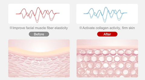 OSUFI™ Revolution-V Face Shaper
