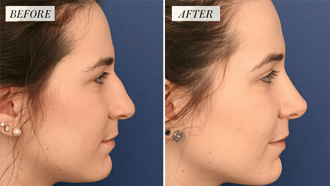 Sci-Effect™ Nose Lift Shaping Oil