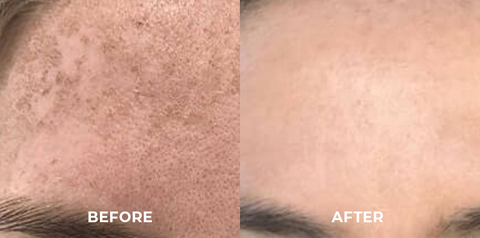 SOUTHERN RI™ Whitening Freckle Removal Cleanser