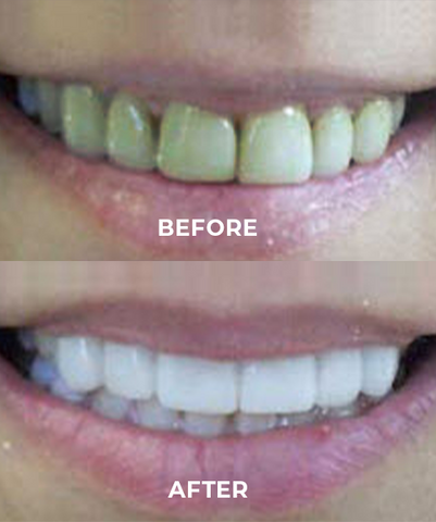 Vibrant Glamour™ Probiotics Bright Whitening Teeth Mousse