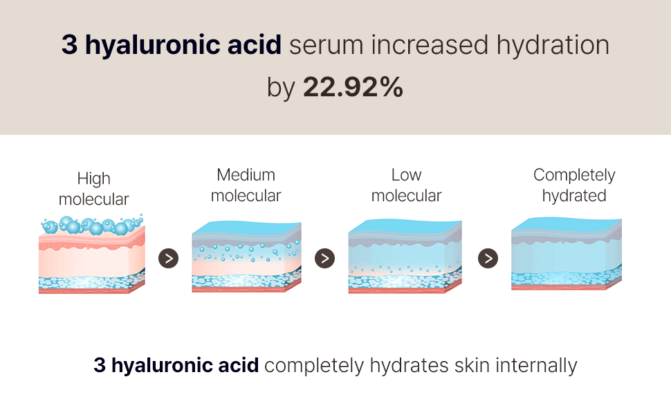 the advantages of three types of hyaluronic acid above small and big moleculars