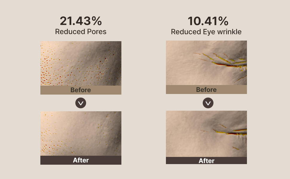 Natural serum reduced pores and eye wrinkle
