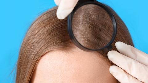 Como ayuda elaceite de CBD al cuero cabelludo