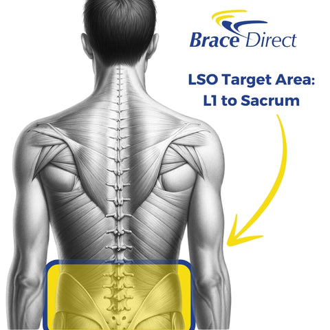 LSO Back Brace for Lumbar Pain Relief