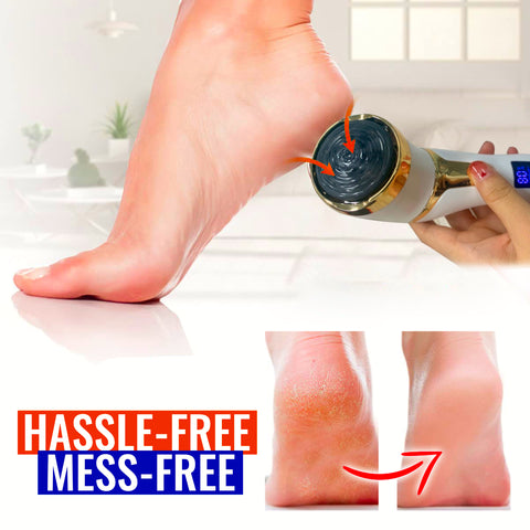 PediPush Rechargeable Foot Callus Remover