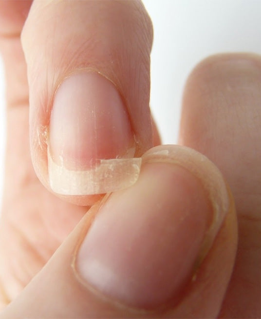 Noticing Brittle & Weak Fingernails