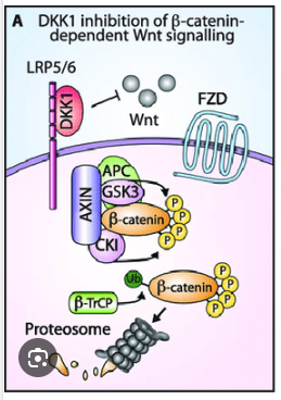 DKK1 negatively regulates Wnt/β-catenin signaling pathway