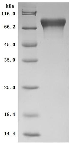The purity was greater than 98.6% as determined by SDS-PAGE.(Tris-Glycine gel) Discontinuous SDS-PAGE (reduced) with 5% enrichment gel and 15% separation gel.