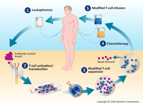 Mechanism of action of CAR T-cell therapy.