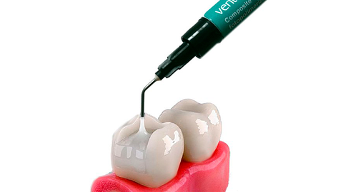 dental composite 