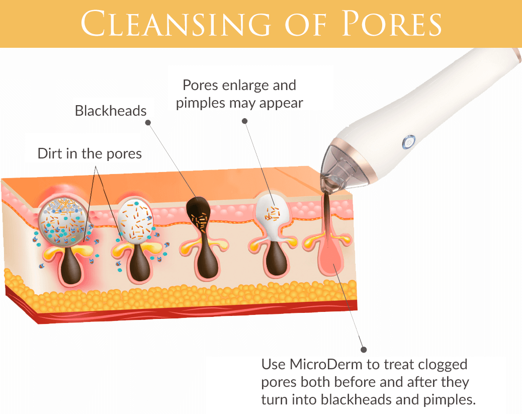 pore cleansing benefits diamond grinding