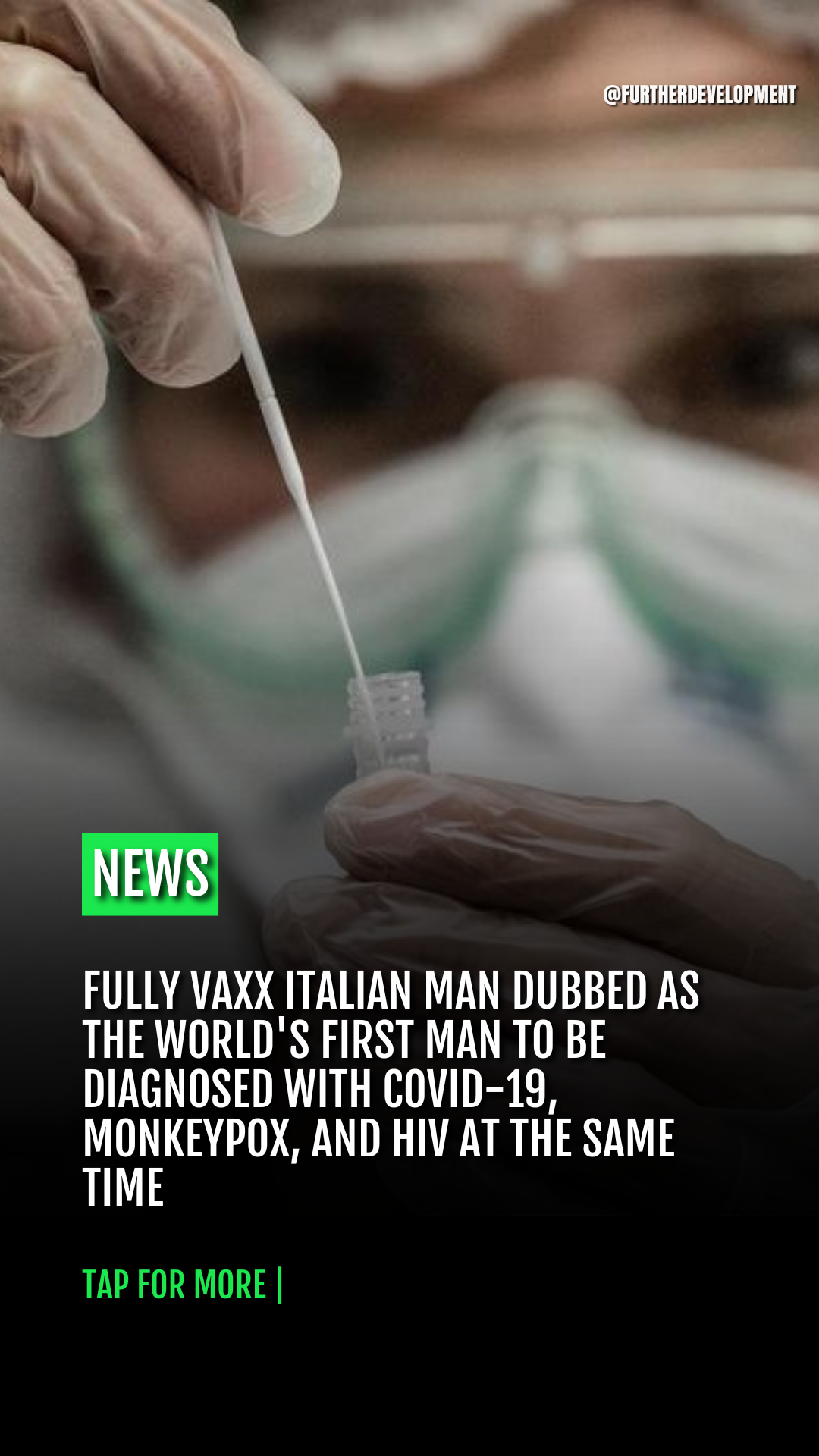 Fully Vaxx Italian Man Dubbed as the World's First Man to be Diagnosed with COVID-19, Monkeypox, and HIV at the Same Time