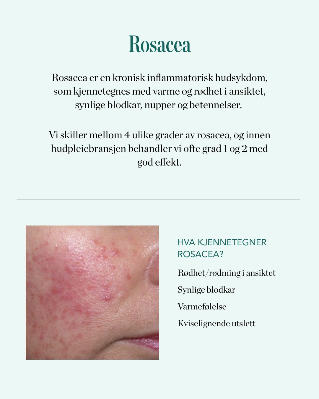 redningen for rosacea - elixir sos paste