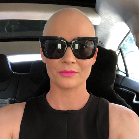 Briony Benjamin with no hair after chemotherapy