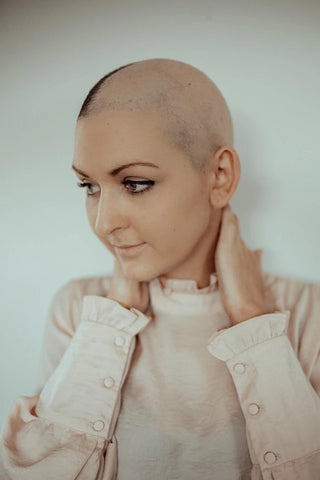 Bryanna with a shaved head